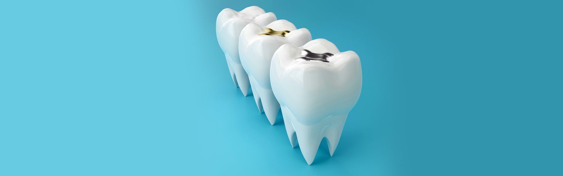 Dental Fillings in Houston, TX