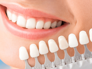 Are Dental Veneers Right for You? A Complete Guide to a Brighter Smile