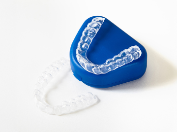 How Do Clear Aligners Work to Straighten Your Teeth